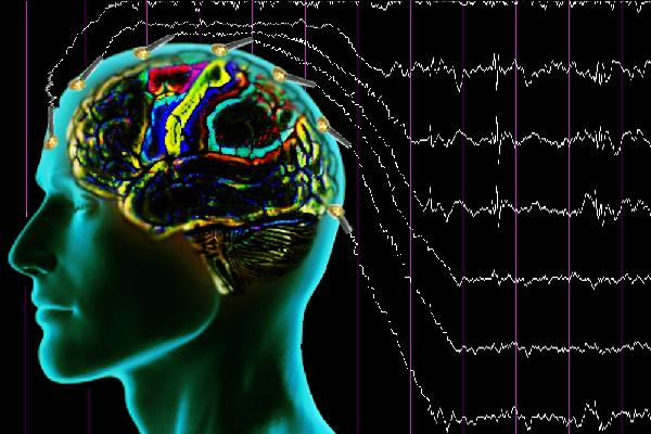 Epilepsi Tanısı Nasıl Konulur?